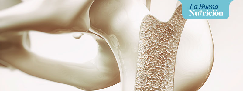 osteoporosis