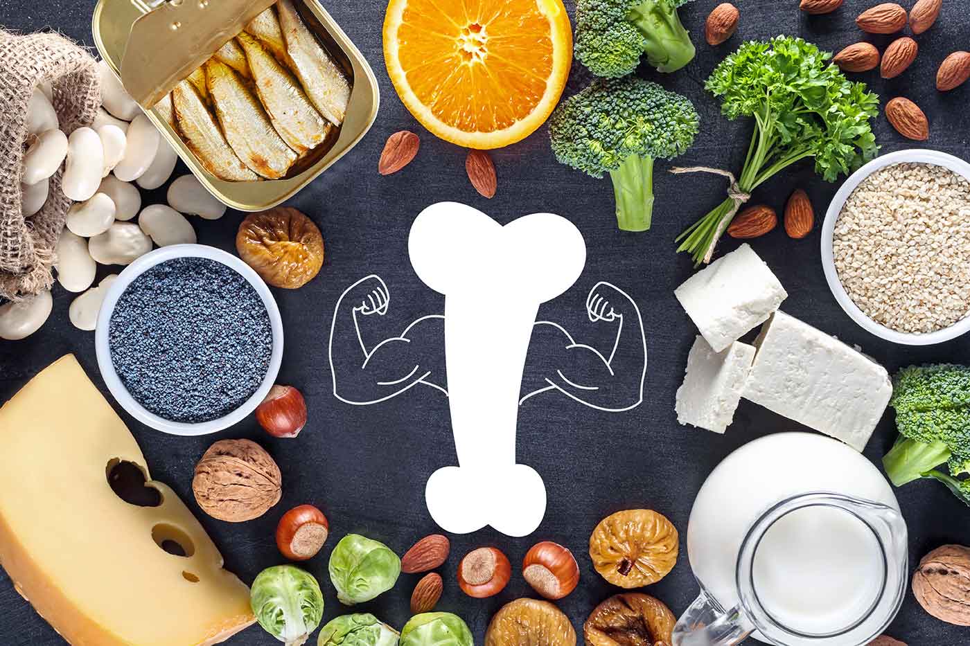 Día Mundial De La Osteoporosis 2022 La Buena Nutrición